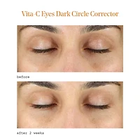 Murad Vita C Dark Circle Corrector Eye Cream