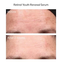 Murad Travel Retinol Youth Renewal Serum