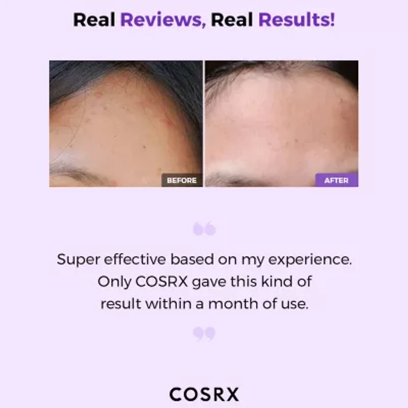 Cosrx Aha/Bha Clarifying Treatment Toner