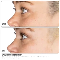 Nip+Fab Vitamin C Fix Concentrate Extreme 15 30ml Face Treatment
