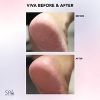 Spa Sciences Viva Advanced Pedicure Foot Smoothing System Callus Remover