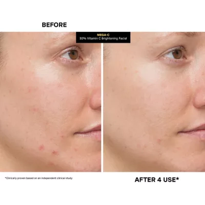 Kate Somerville Mega-C 30% Vitamin C Brightening Facial - 60 mL / 2 Fl. Oz.