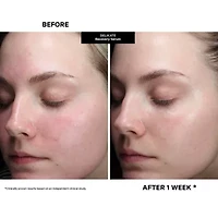 Kate Somerville DeliKate Recovery Serum - 30 ml / 1 fl oz