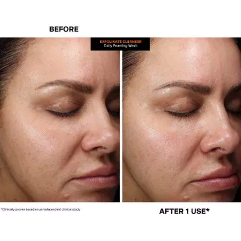 Kate Somerville ExfoliKate Cleanser Daily Foaming Wash