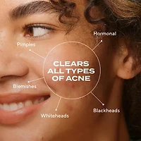 Murad Biome-Balancing Clear & Prevent Acne Treatment Serum