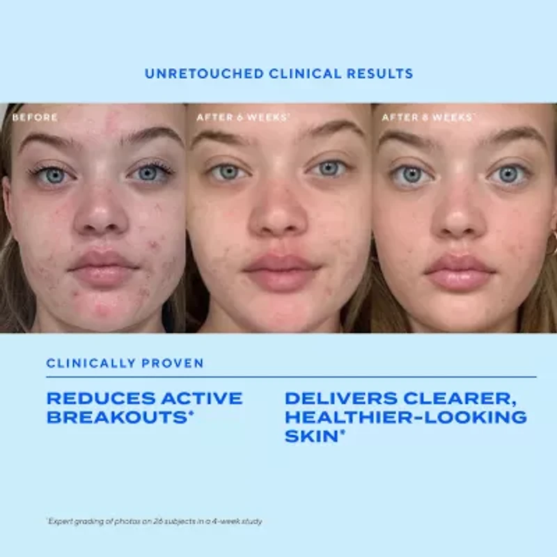 Murad Biome-Balancing Clear & Prevent Acne Treatment Serum