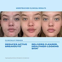 Murad Biome-Balancing Clear & Prevent Acne Treatment Serum