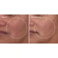 Murad Cellular Hydration Barrier Repair Serum