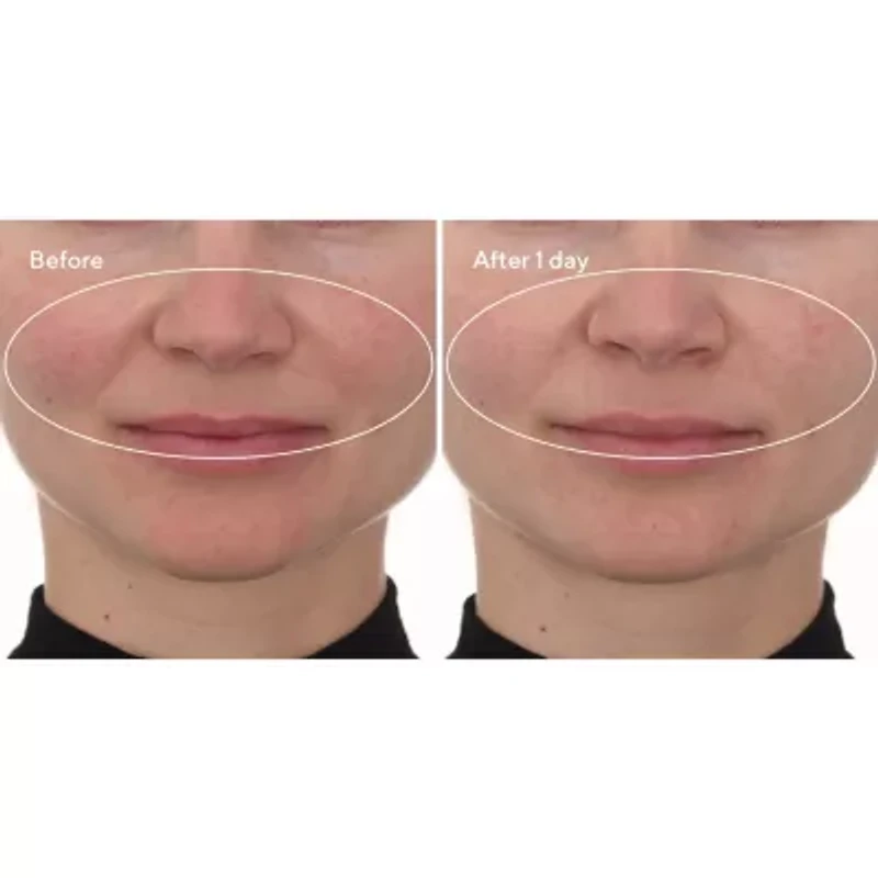 Murad Cellular Hydration Barrier Repair Mask