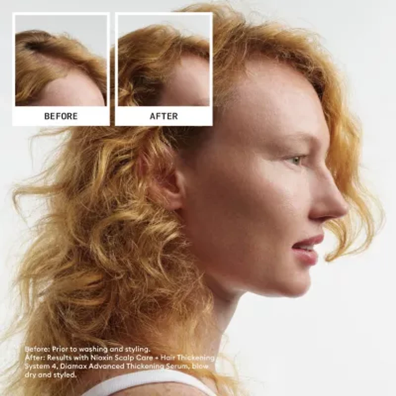 Nioxin System 4 Kit 300+300+100 Hair Loss Treatment