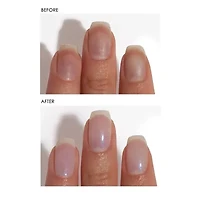 Dermelect Luminous Nail Treatment
