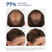 BosleyMD Mens Regrowth Spray Hair Treatment 2 oz.