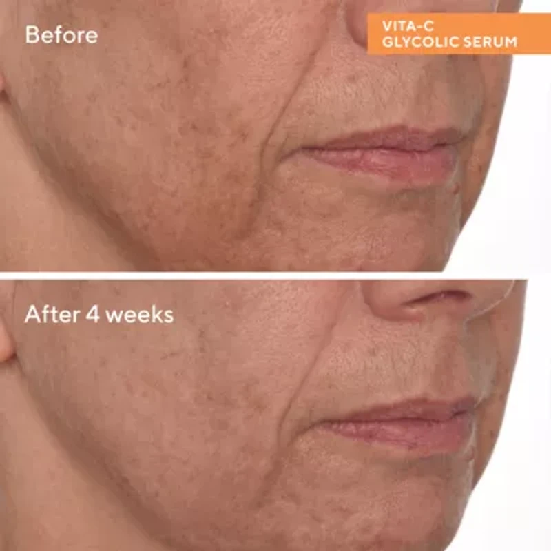 Murad Vita-C Glycolic Brightening Serum