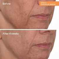 Murad Vita-C Glycolic Brightening Serum