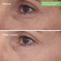Murad Retinal Resculpt Eye Lift Treatment