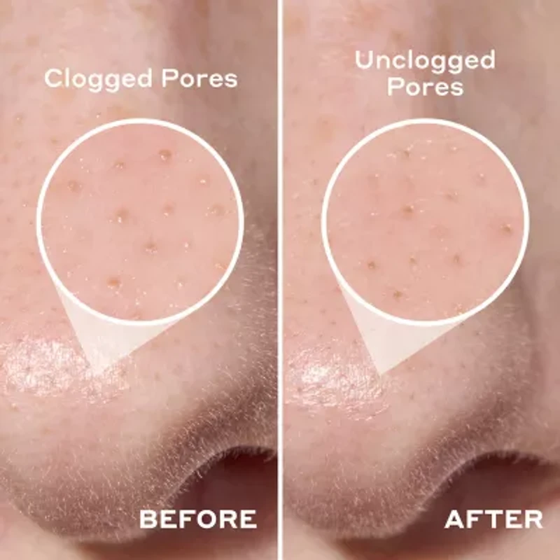 Mario Badescu Pore Strip Cleanser