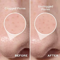 Mario Badescu Pore Strip Cleanser