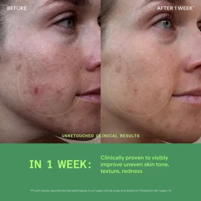 Murad Biome-Balancing Calm + Recover Cream