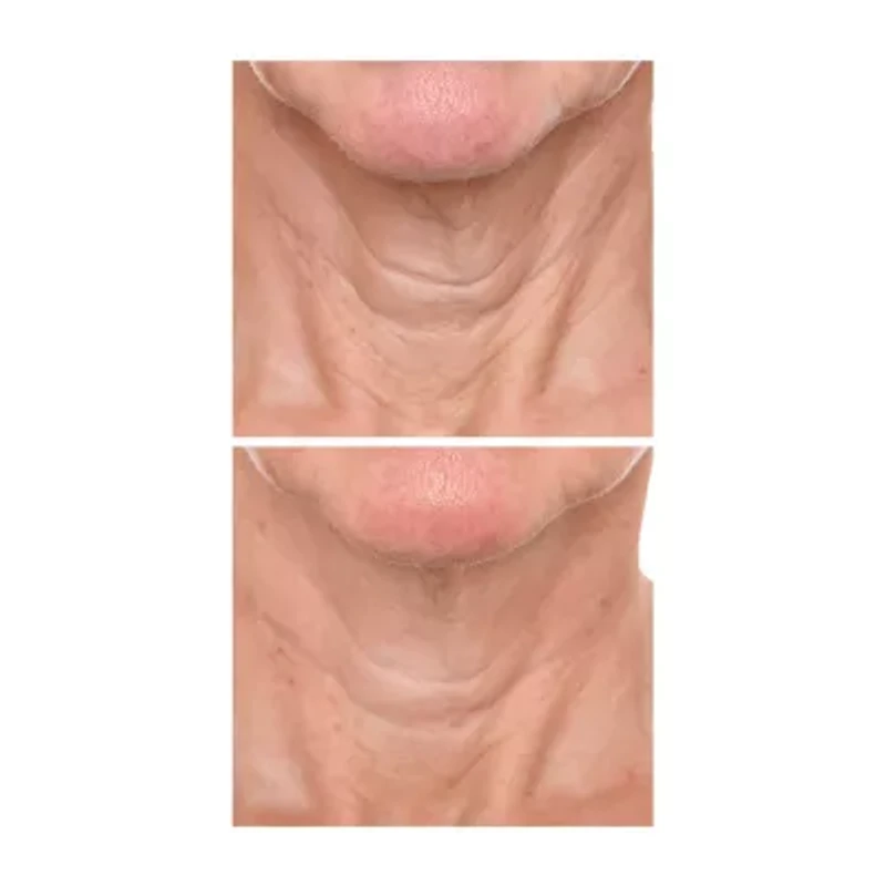 PRAI Beauty Ageless Throat & Decolletage Creme