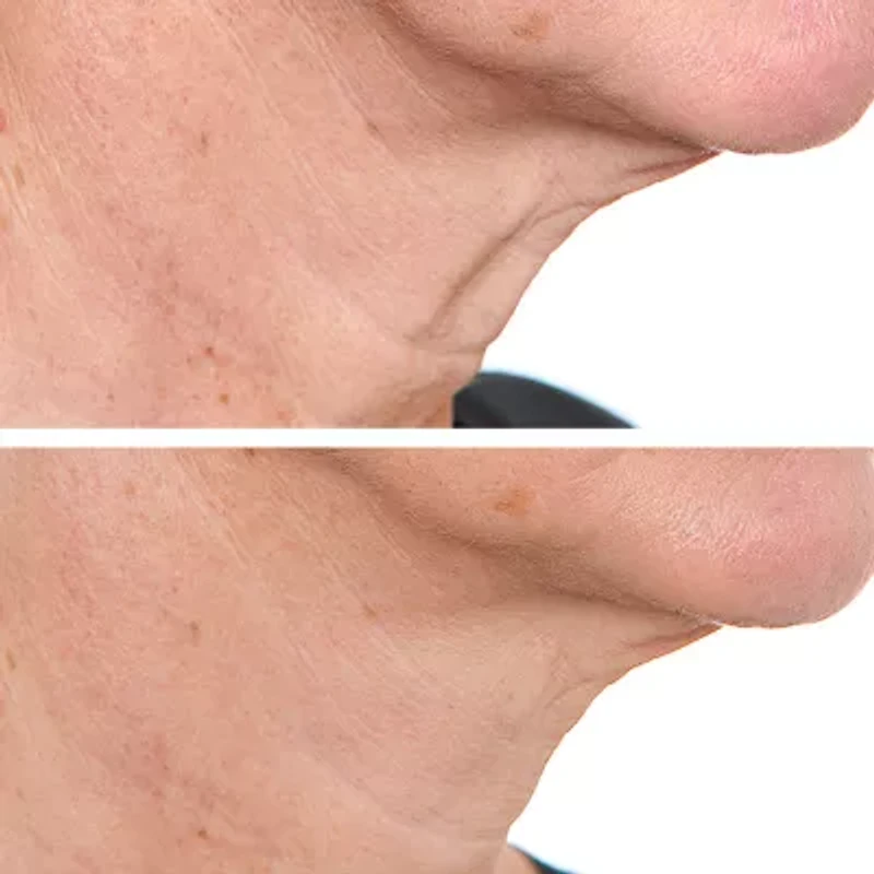 PRAI Beauty Ageless Throat & Decolletage Creme