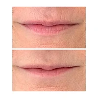 PRAI Beauty Ageless Lip Line Filler