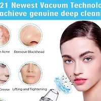 Prospera Blackhead Remover Kit