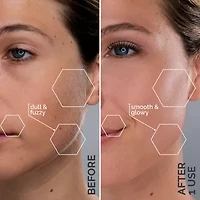 Spa Sciences Sima Sonic Facial Exfoliation And Hair Removal System