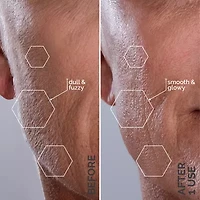 Spa Sciences Sima Sonic Facial Exfoliation And Hair Removal System