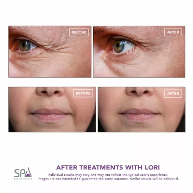 Spa Sciences Lori- Facial Lifting & Serum Infusion Wand With Cold & Heat Therapy For Eyes & Lips