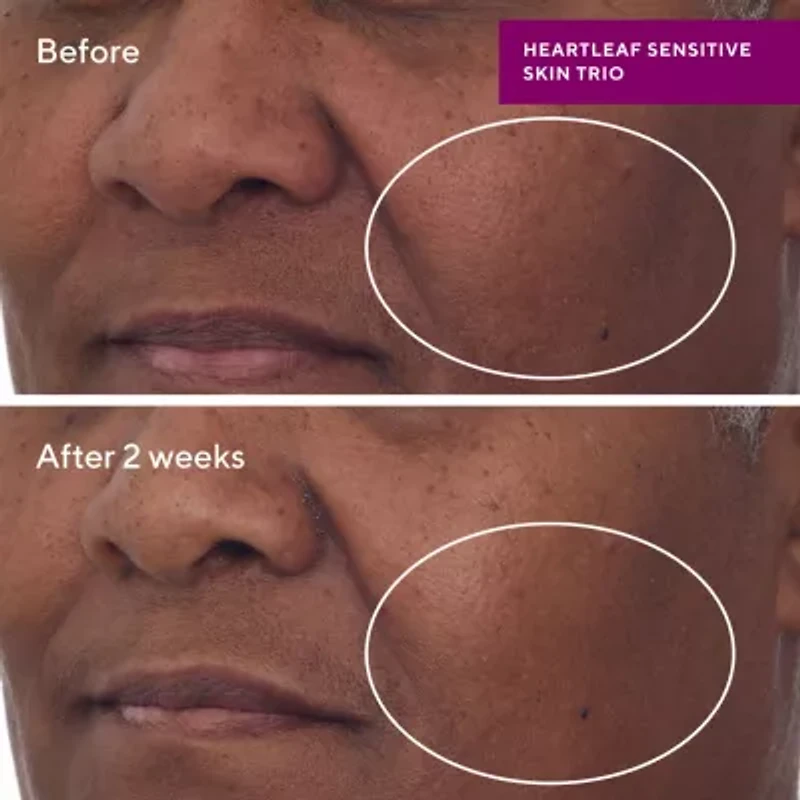 Murad Heartleaf Soothing Cleanser