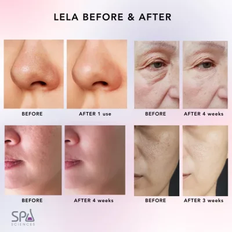 Spa Sciences Lela Ultrasonic Skin Spatula