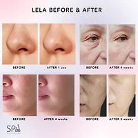Spa Sciences Lela Ultrasonic Skin Spatula