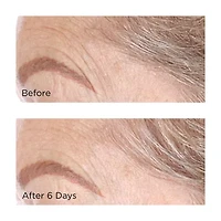 Perricone MD Cold Plasma Plus+ Concentrated Treatment Sheet Mask Single
