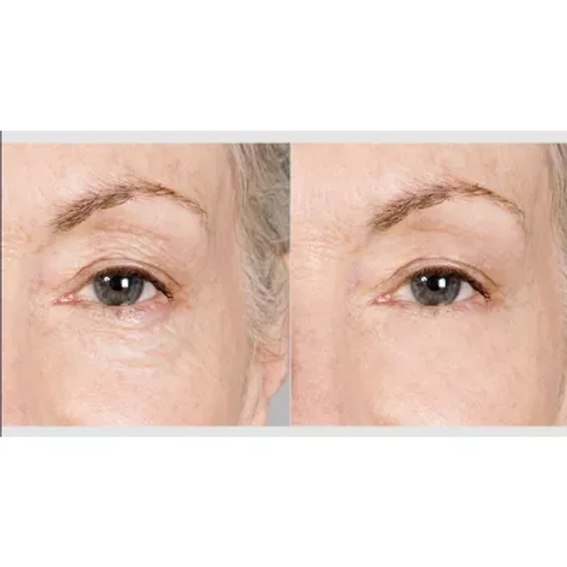 Prospera Pink Ceramic Hair Straightener & Mini Body