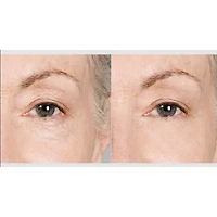 Prospera Pink Ceramic Hair Straightener & Mini Body