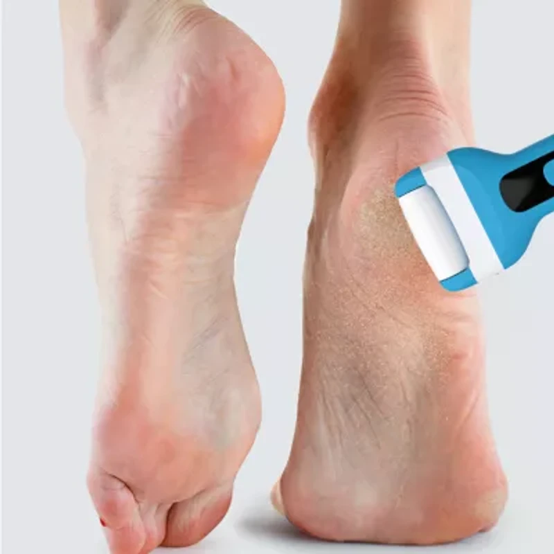 Prospera Electric Foot Callus Removers Rechargeable, Portable