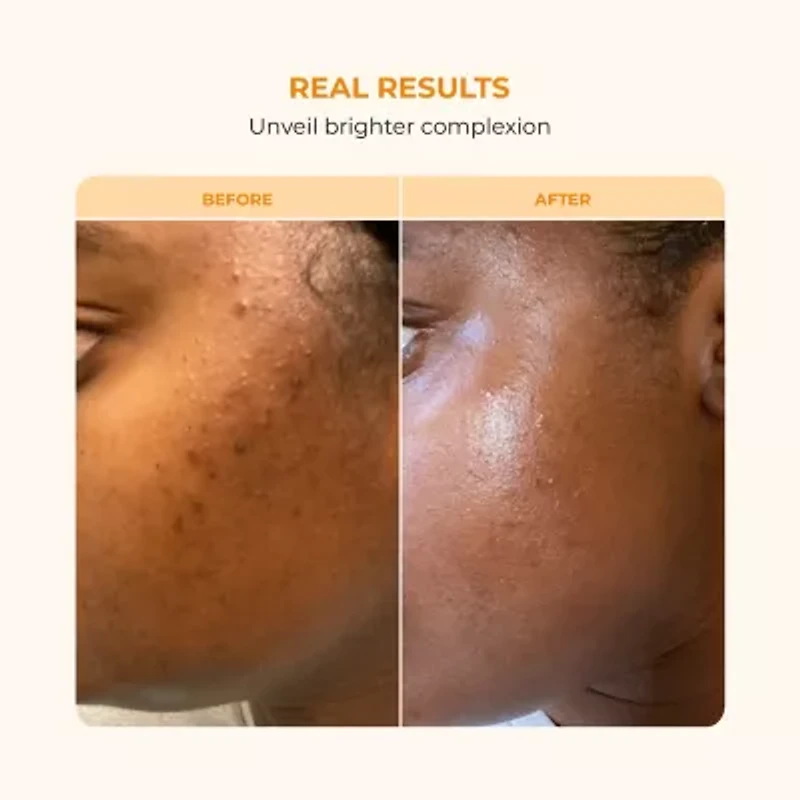 Buttah Skin Vitamin C Serum