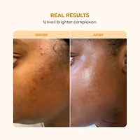 Buttah Skin Vitamin C Serum