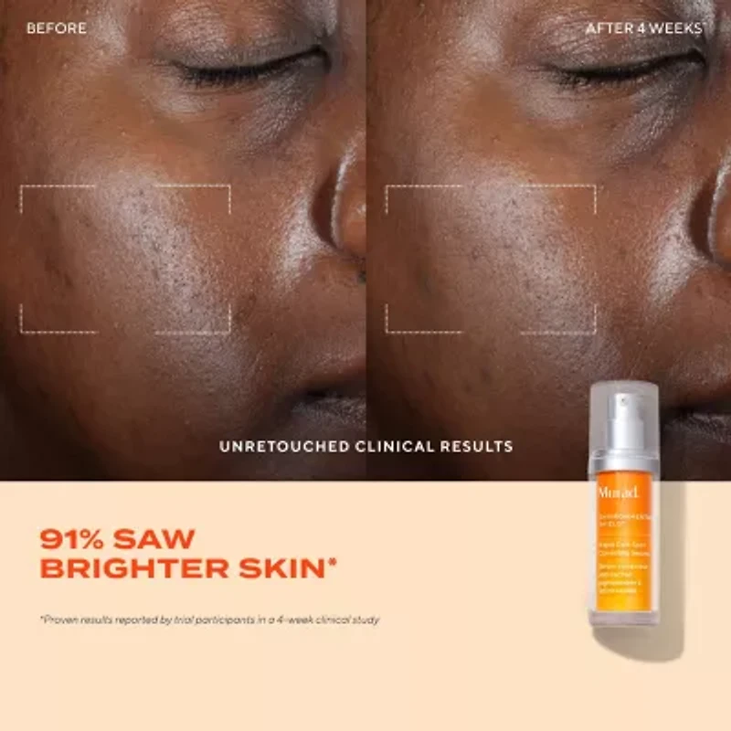 Murad Rapid Dark Spot Correcting Serum