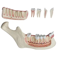 Walter Products Lower Jaw Model