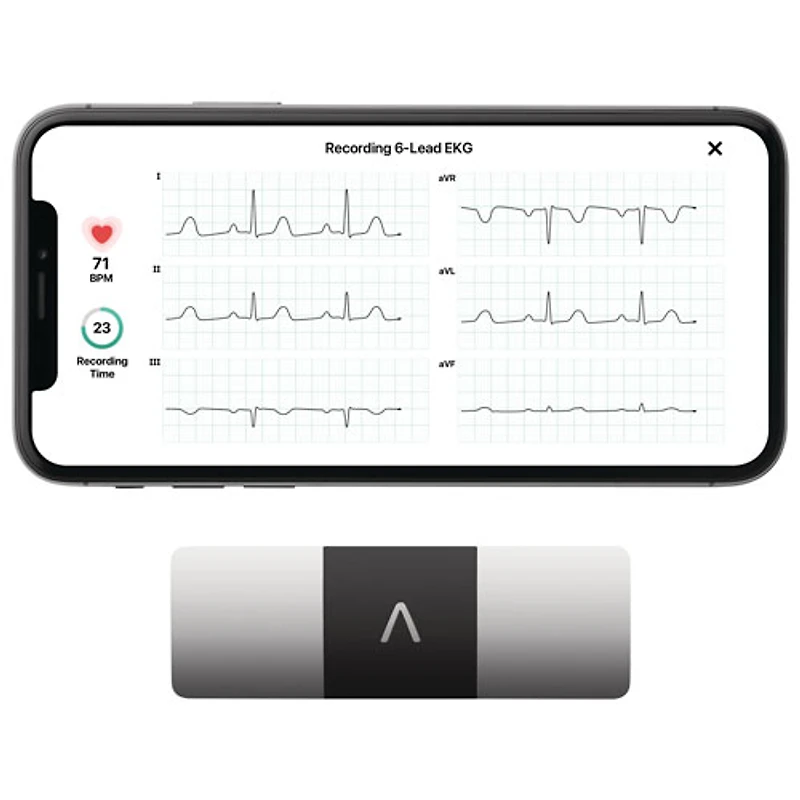 KardiaMobile 6L Portable EKG Monitor (AC-019-NUA-A)