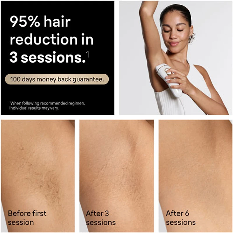 Système d'épilation à sec IPL Silk Expert Pro 5 de Braun (PL5157)