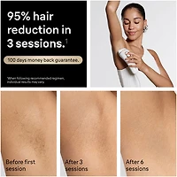 Système d'épilation à sec IPL Silk Expert Pro 5 de Braun (PL5157)