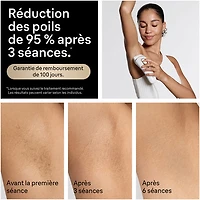 Système d'épilation à sec IPL Silk Expert Pro 5 de Braun (PL5157)