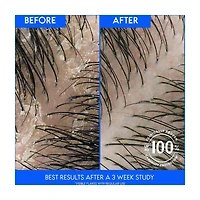 Head & Shoulders 2 in 1 Dandruff Shampoo & Conditioner, Tea Tree Oil, 12.5 fl oz