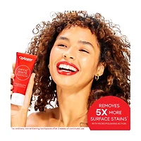 Colgate Optic White Stain Fighter Stain Removal Toothpaste, Fresh Mint Gel, 4.2 oz