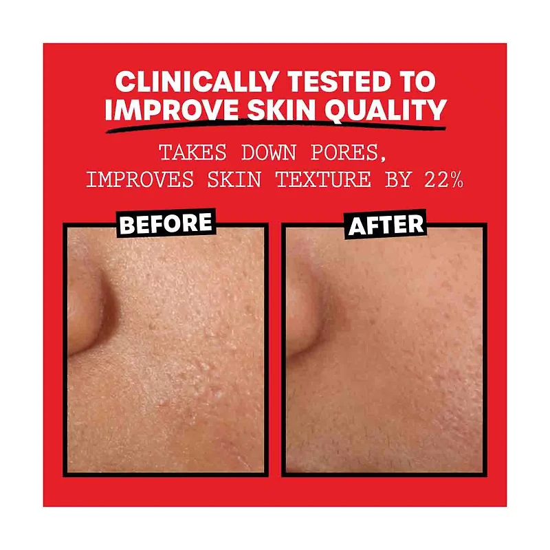 Thayers Witch Hazel Rose Toner 3oz