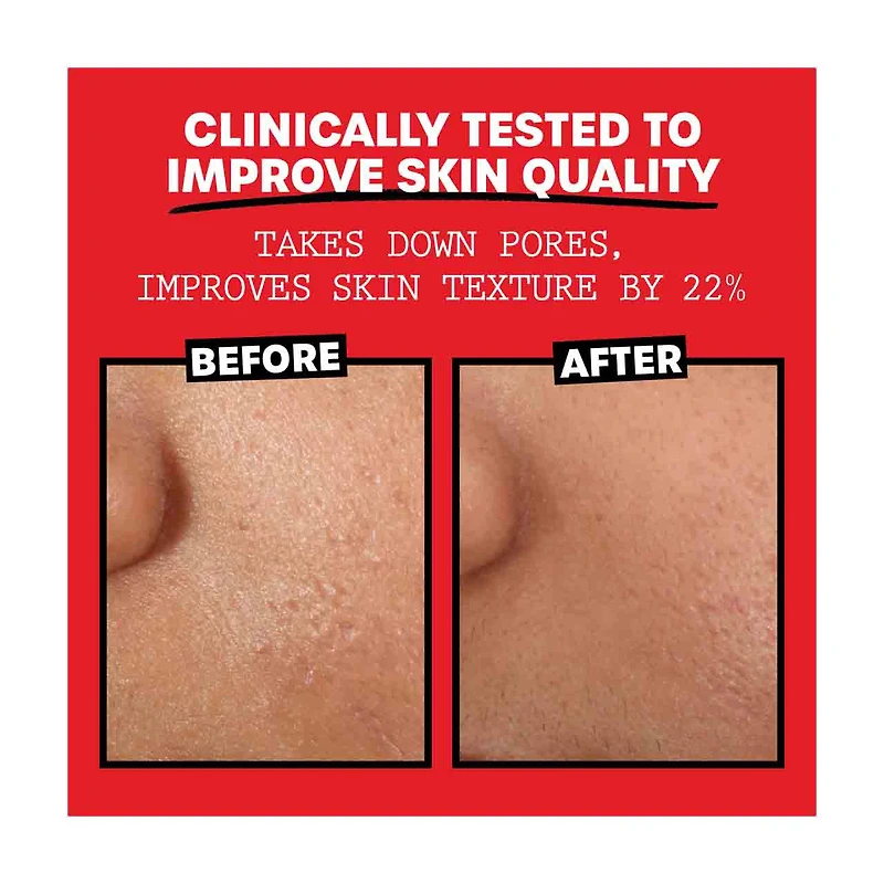 Thayers Witch Hazel Rose Toner 3oz