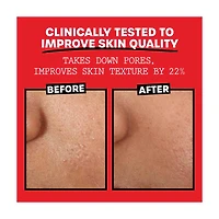 Thayers Witch Hazel Rose Toner 3oz