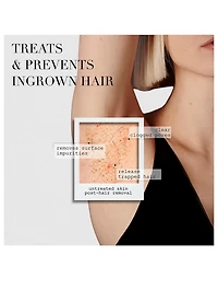 The Ingrown Bar